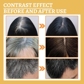 GrowHair – Proskire Anti-Grey Hair Serum