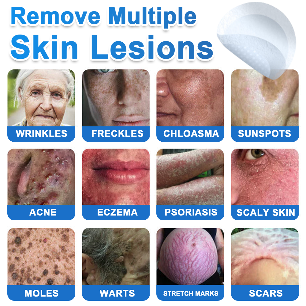 GlowSkin -  2-in-1 Microneedle & Hydrocolloid Star Patch