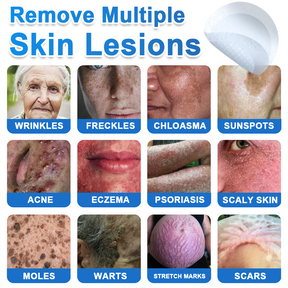 GlowSkin -  2-in-1 Microneedle & Hydrocolloid Star Patch