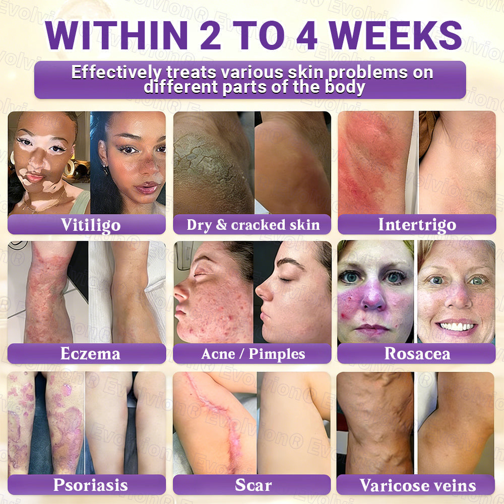 DermaVive – Biotin 10-in-1 Skin Restoration Cream