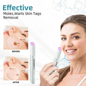 CleanBeam – Multi Function CO₂ Laser Eraser Pen Tool