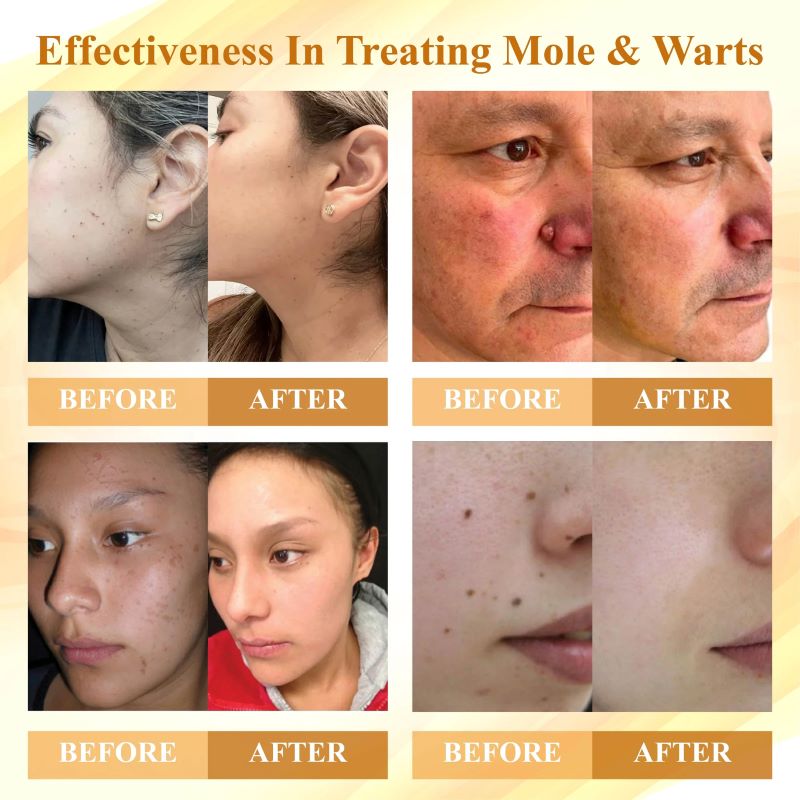 DermaVenom – Advanced Skin Repair Cream