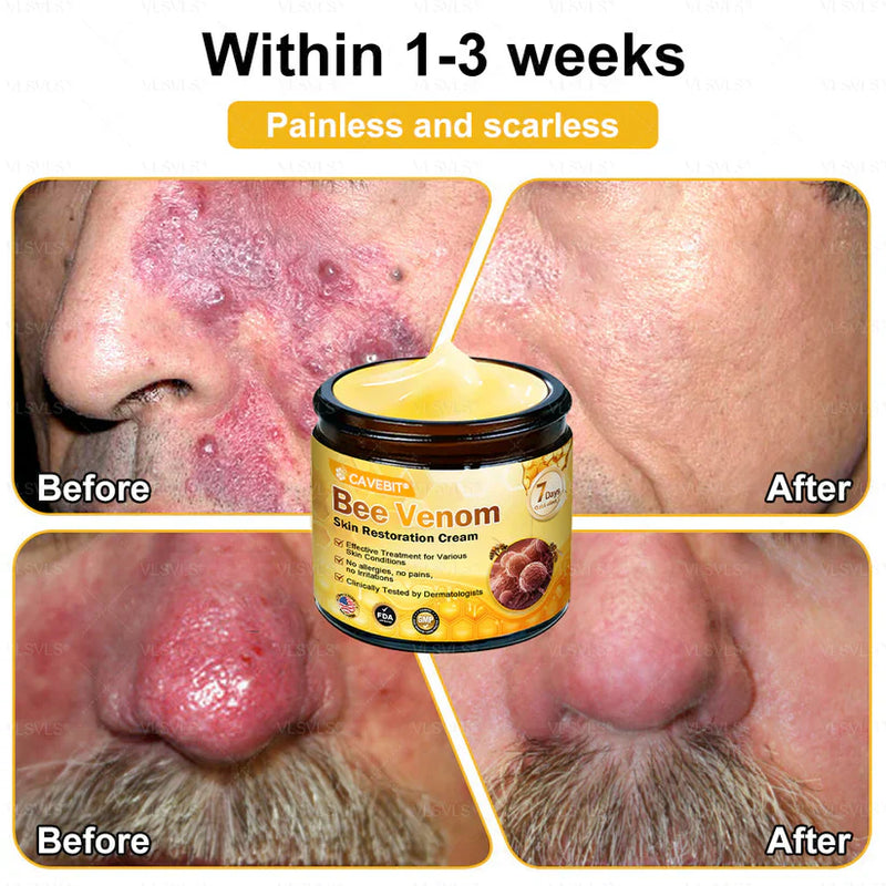 BeeLuxe – Premium Bee Venom Firming Face Cream