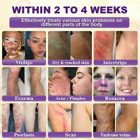 SkinRevive –  Biotin 10-in-1 Skin Restoration Cream
