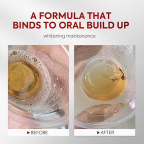 AuraWhite – Advanced Stain-Lifting Whitening Mouthwash