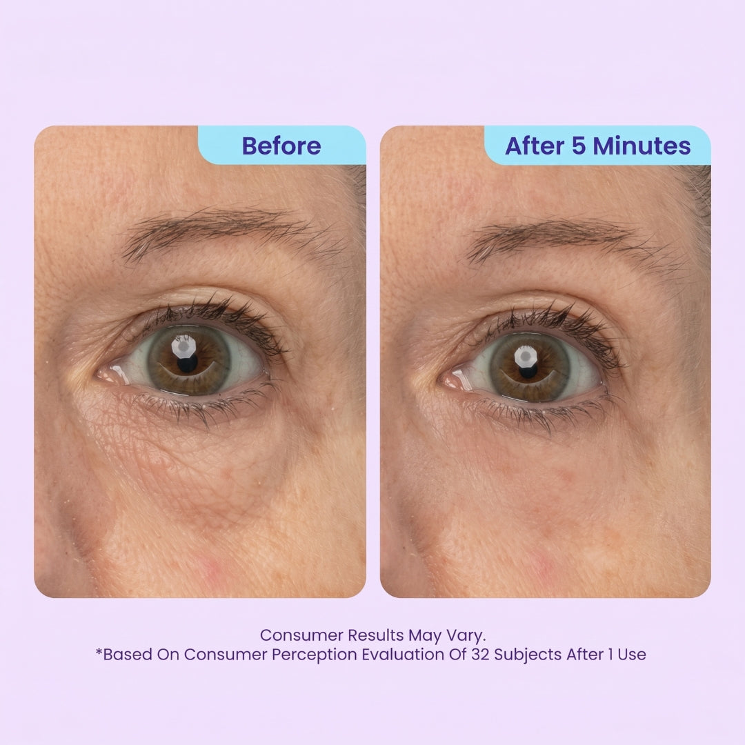 BrightLift – Instant Eye Rejuvenator