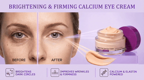 ClearLift – Under-Eye Brightening Cream