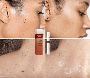 ClearGuard – Effective Wart Removal Pen