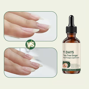 BeautyTips – Nail Repair Miracle Drops