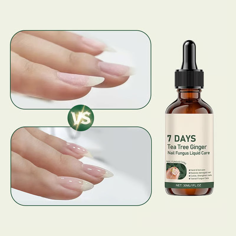 BeautyTips – Nail Repair Miracle Drops