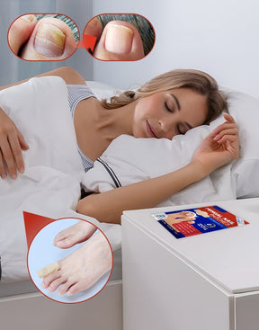 FungiCare – Advanced Nail Repair Patches