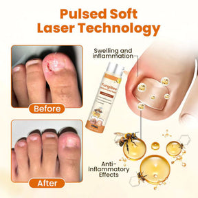 VenomNail Care – Deep Repair & Protection Formula