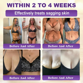 SkinRevive –  Biotin 10-in-1 Skin Restoration Cream