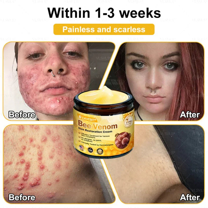 BeeLuxe – Premium Bee Venom Firming Face Cream