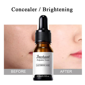 DermaYouth – Argireline Anti-Aging Formula