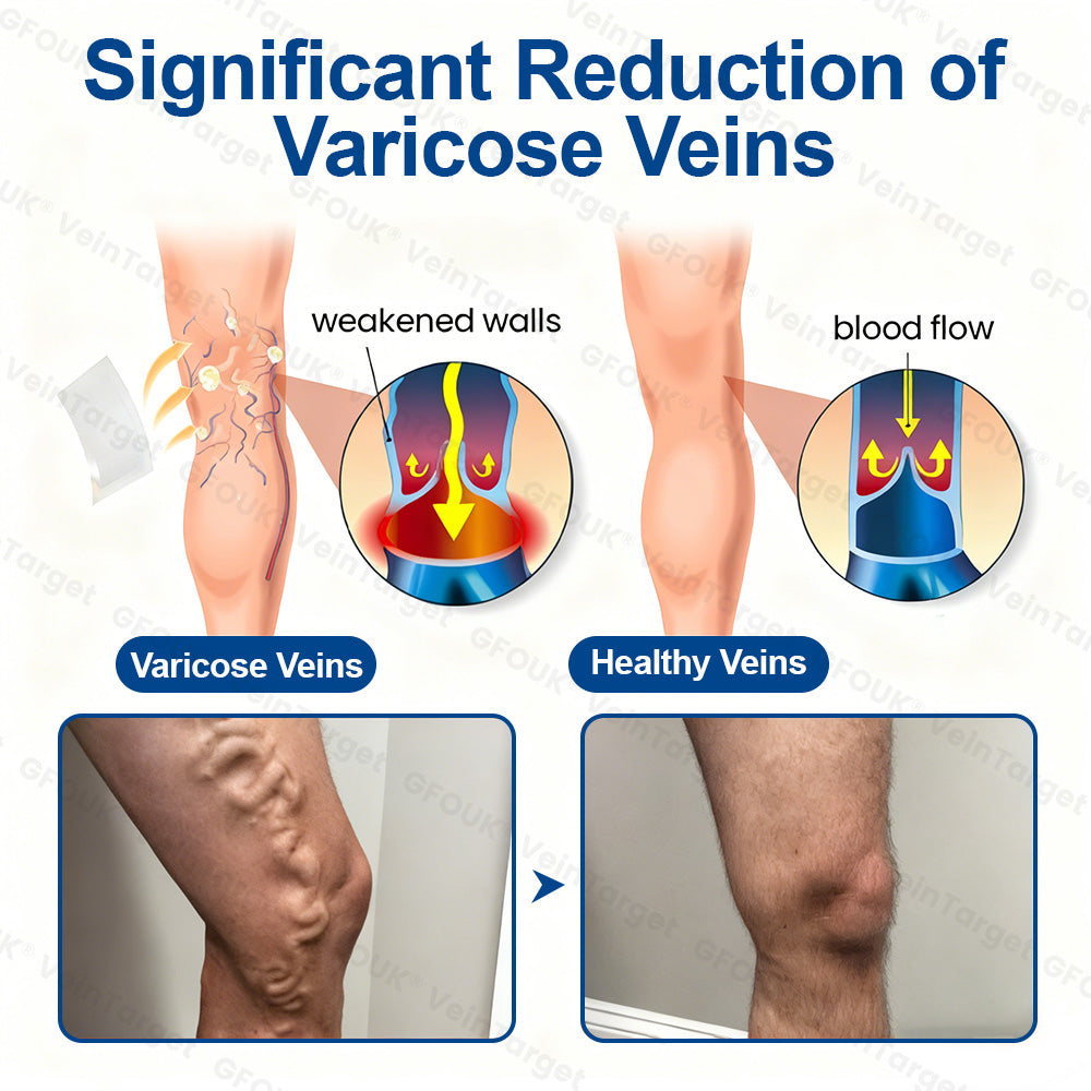 🇺🇸👨‍⚕️✅✅GFOUK® VeinTarget Microneedle Patch⚡Instant Relief, Long-Term Results