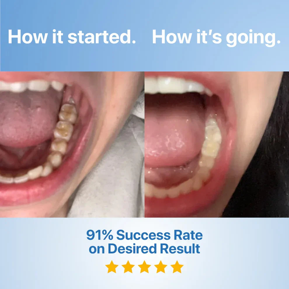 DentiGlow – Fluoride Free Tooth Repair Formula