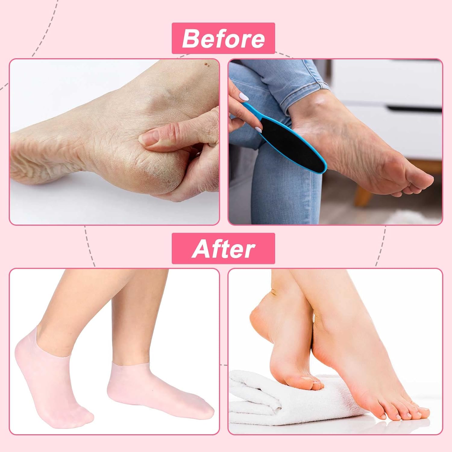 VelvetHeel Socks – Smooth Skin Foot Care