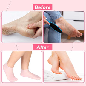 VelvetHeel Socks – Smooth Skin Foot Care