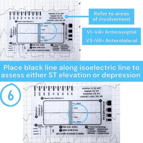 MediTrack – Professional ECG Assessment Pocket Guide