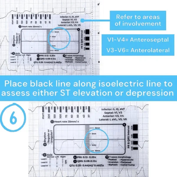MediTrack – Professional ECG Assessment Pocket Guide
