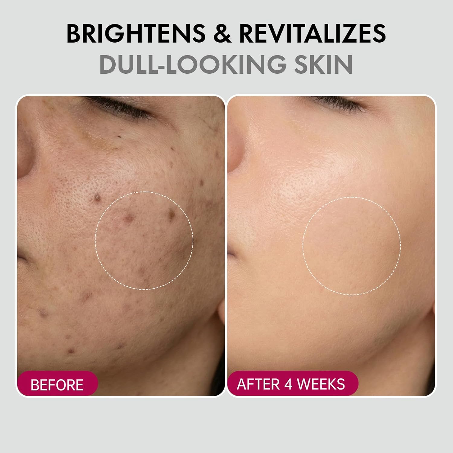 DermaGlow – Advanced Skin Renewing Treatment Cream