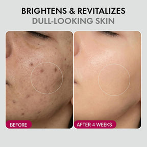 DermaGlow – Advanced Skin Renewing Treatment Cream