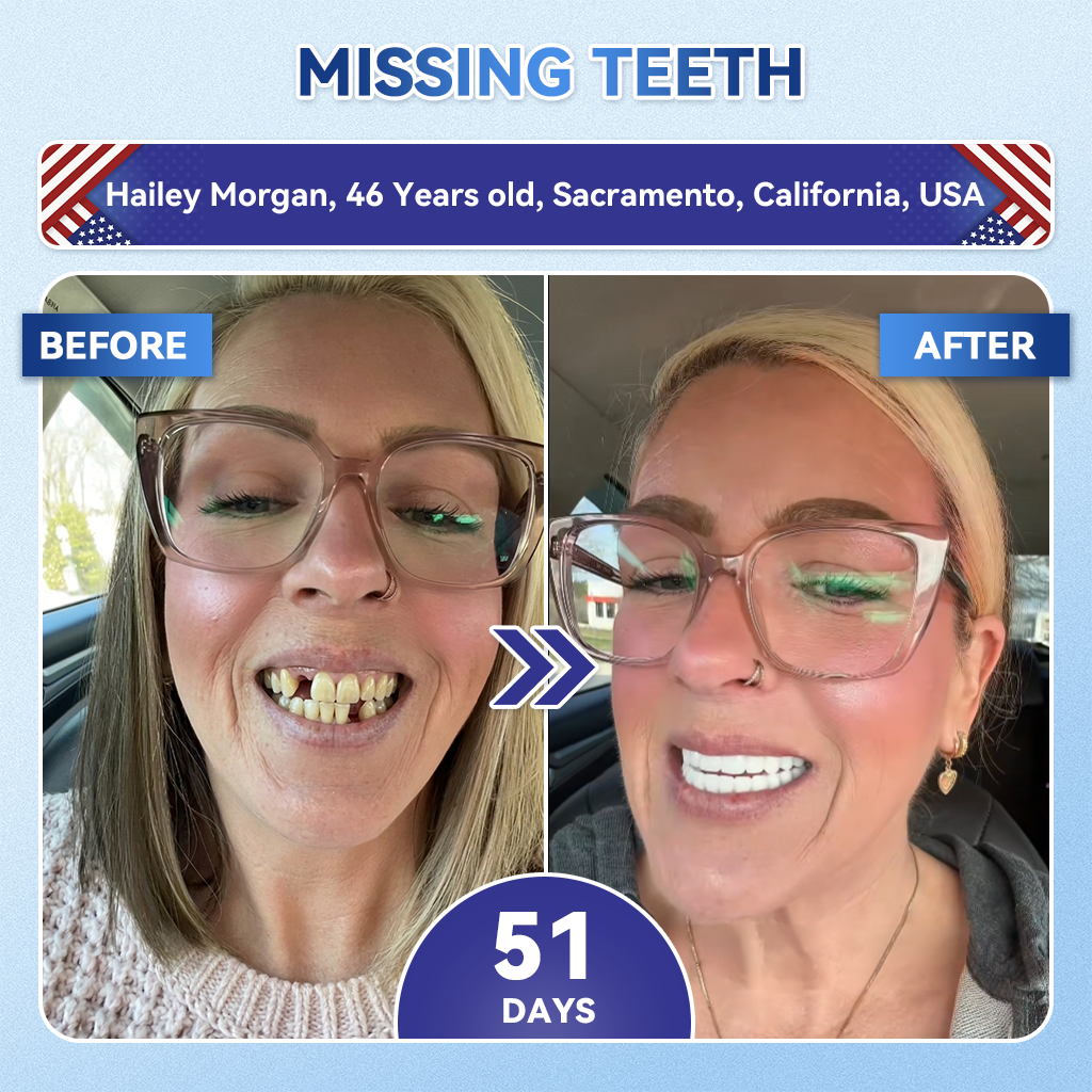 Dentafresh Pro – Whitening Repair Strips