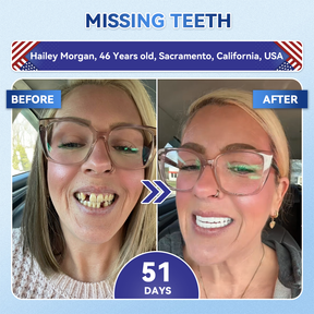 Dentafresh Pro – Whitening Repair Strips
