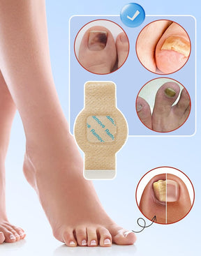 FungiCare – Advanced Nail Repair Patches