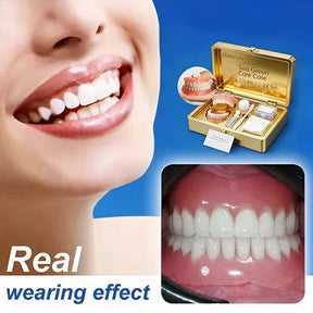 SmileLock – Premium Full Denture Solution