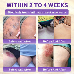 DermaVive – Biotin 10-in-1 Skin Restoration Cream