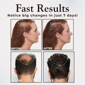 ThriveHair – Premium Hair Growth & Strength Formula