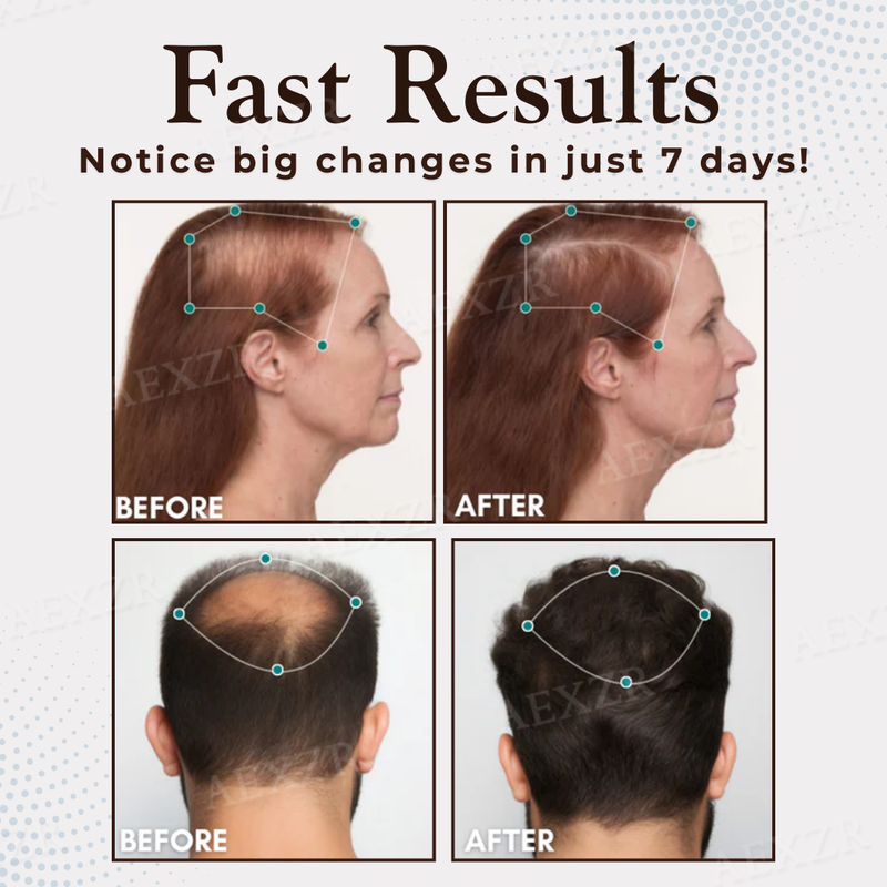 ThriveHair – Premium Hair Growth & Strength Formula