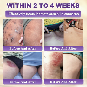 SkinRevive –  Biotin 10-in-1 Skin Restoration Cream