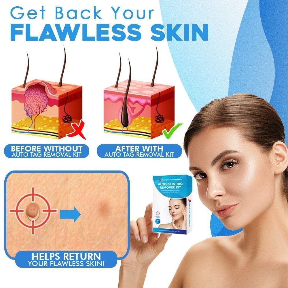TagGone - Quick & Safe Skin Tag Remover