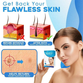 TagGone - Quick & Safe Skin Tag Remover