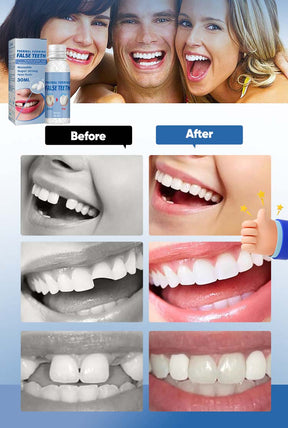 DentaForm – Custom Fit Instant Tooth Filling Solution