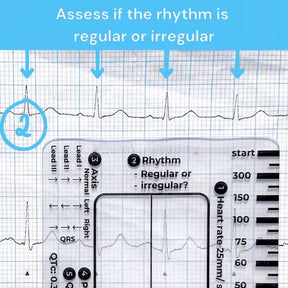 MediTrack – Professional ECG Assessment Pocket Guide