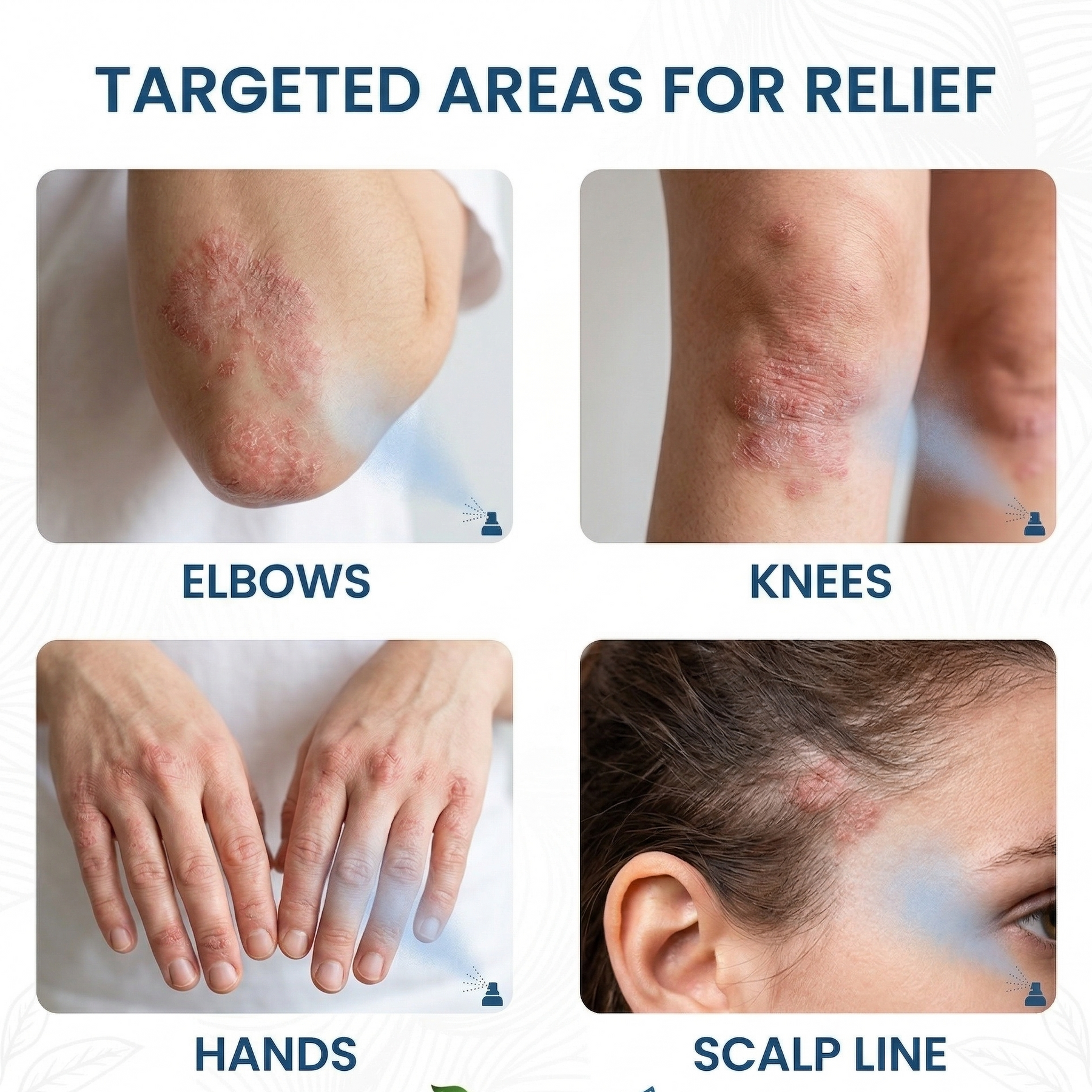 DermaCalm – Magnesium Botanical Spray