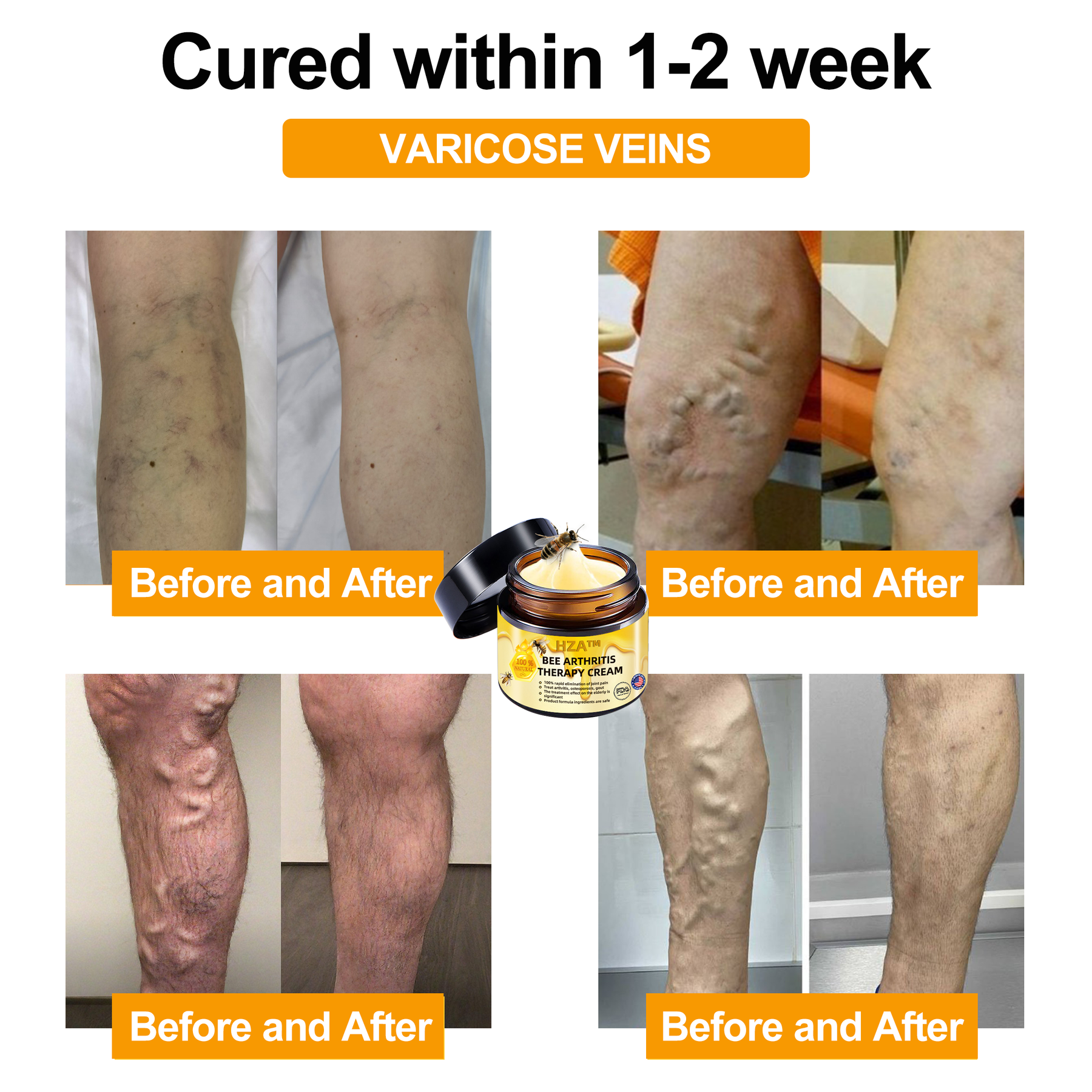 JointEase – Fast-Acting Pain Relief Cream