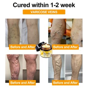 JointEase – Fast-Acting Pain Relief Cream