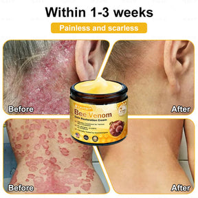 BeeLuxe – Premium Bee Venom Firming Face Cream