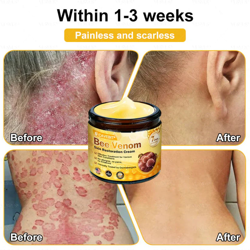 BeeLuxe – Premium Bee Venom Firming Face Cream