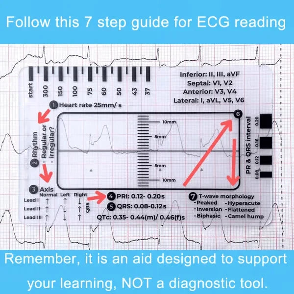 MediTrack – Professional ECG Assessment Pocket Guide