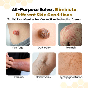 SkinRelief – Deep Moisture Repair Cream