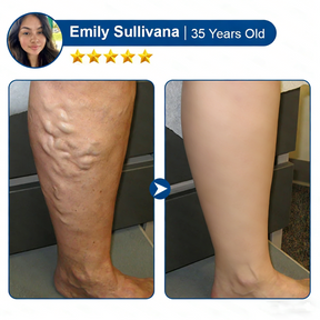 LegEase – Comfortable Vein Care Patch System