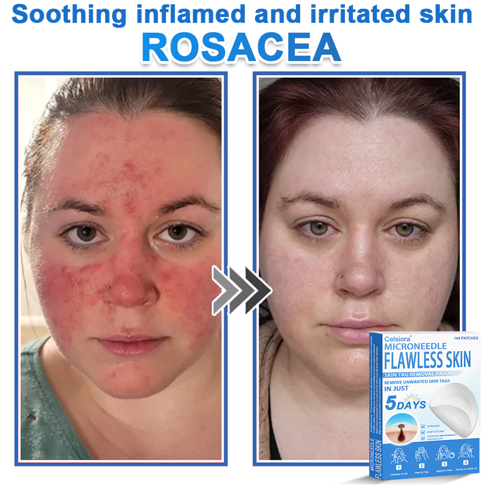 GlowSkin -  2-in-1 Microneedle & Hydrocolloid Star Patch