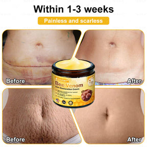 BeeLuxe – Premium Bee Venom Firming Face Cream