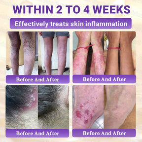 DermaVive – Biotin 10-in-1 Skin Restoration Cream